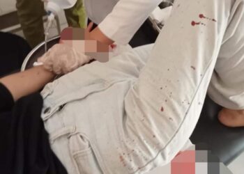 Perampokan di Mini ATM, Jari Karyawan Nyaris Putus